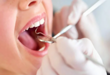 آیا بیمه تکمیلی آسیا شامل دندانپزشکی می شود