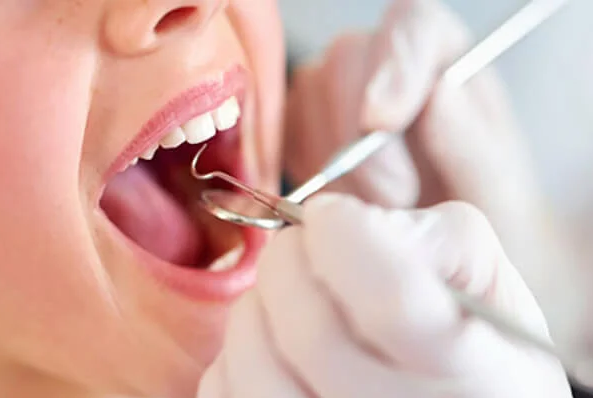 آیا بیمه تکمیلی آسیا شامل دندانپزشکی می شود